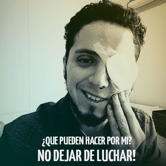 Diego Lastra (27), interno de 7mo año de medicina de la Universidad Diego Portales, perdió la visión de su ojo izquierdo luego de recibir el impacto de una bomba lacrimógena, según relatan los testigos. Foto: Facebook.