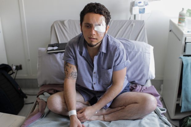 La madrugada del 1 de enero, Diego Lastra se convirtió en el primer mutilado del año 2020. Una bomba lacrimógena disparada por efectivos de Carabineros le causó tres fracturas en el rostro y el estallido de su globo ocular izquierdo. Cuenta que apenas sintió el el impacto supo que había perdido la vista. Así lo confirmaron los doctores tras la primera cirugía, en la que dieron cuenta del nivel del daño y, en una segunda, con placas de metal le reconstruyeron el pómulo, el párpado y lagrimal. Foto: Tomás González F.