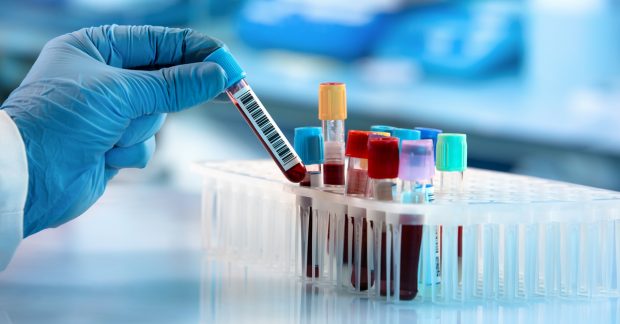 Durante la última jornada se confirmaron 220 nuevos casos confirmados de COVID-19, con lo que el número de contagiados llegó a 1.142 en el país. También aumentó la cifra de pacientes recuperados del virus, alcanzando los 22 casos. Foto: Archivo.