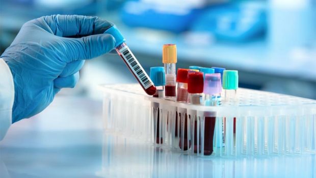Desde la Sociedad Chilena de Infectología señalaron que un test PCR negativo en una persona asintomática "no permite dar certezas ni seguridad respecto a su poder de contagiosidad y diseminación en los días posteriores, y esa persona debe completar la cuarentena en aislamiento social". Foto: Archivo.