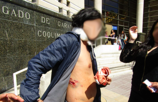 Así llegó Jonathan a la audiencia de control de detención al día siguiente de haber recibido un escopetazo en su espalda. La detención fue declarada ilegal y fue liberado. Foto: Radio Universidad de Chile.