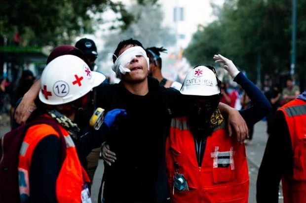 Víctimas de trauma ocular del estallido social.