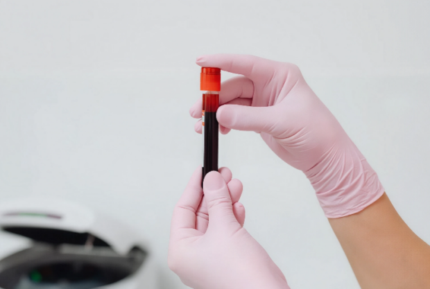 Muestra de sangre